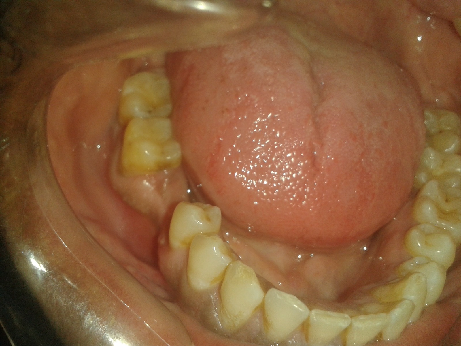 surgery-after