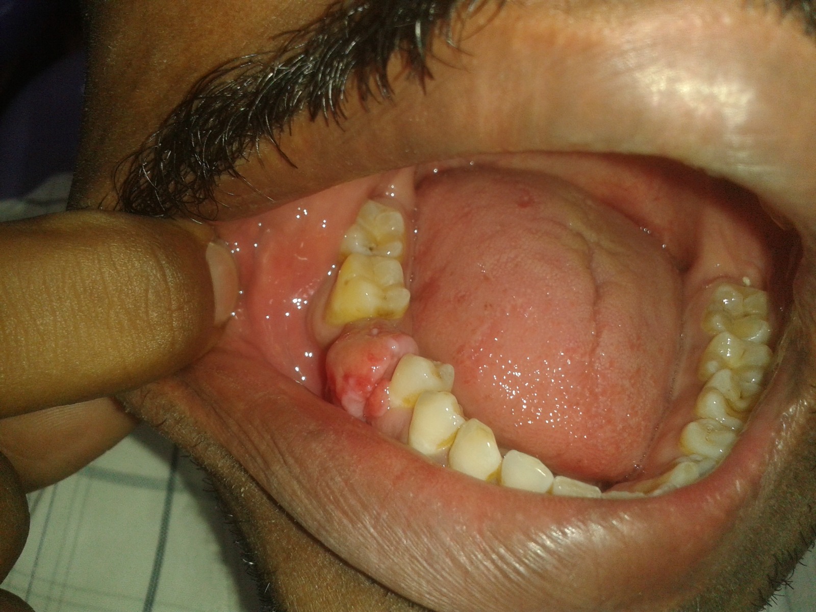 surgery-before